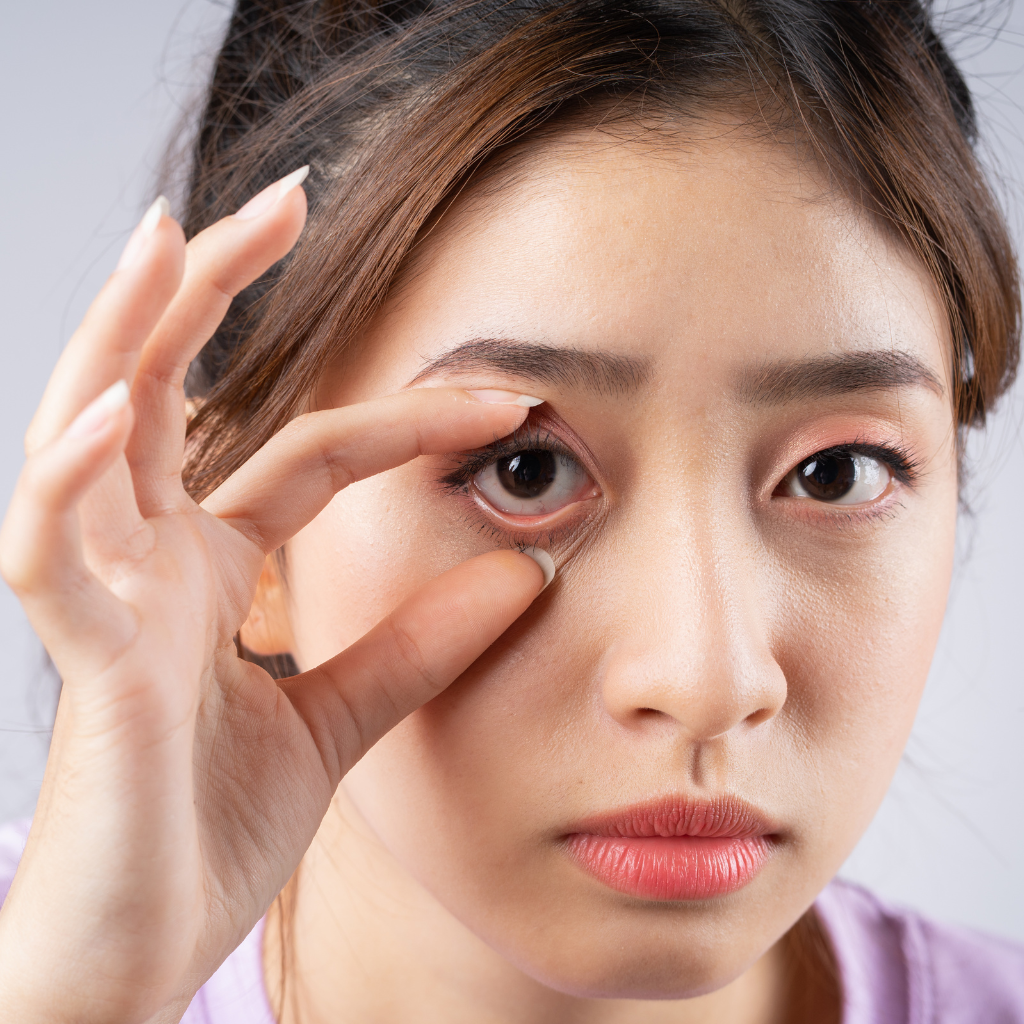 รู้จักกับโรคกล้ามเนื้อตาอ่อนแรง พร้อมแนะนำวิธีรักษาอย่างเห็นผล 2